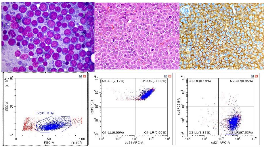 LA PROGNOSI DEL LINFOMA DLBCL DEL CANE: NUOVE PROSPETTIVE SULL'INTERAZIONE SISTEMA IMMUNITARIO-NEOPLASIA