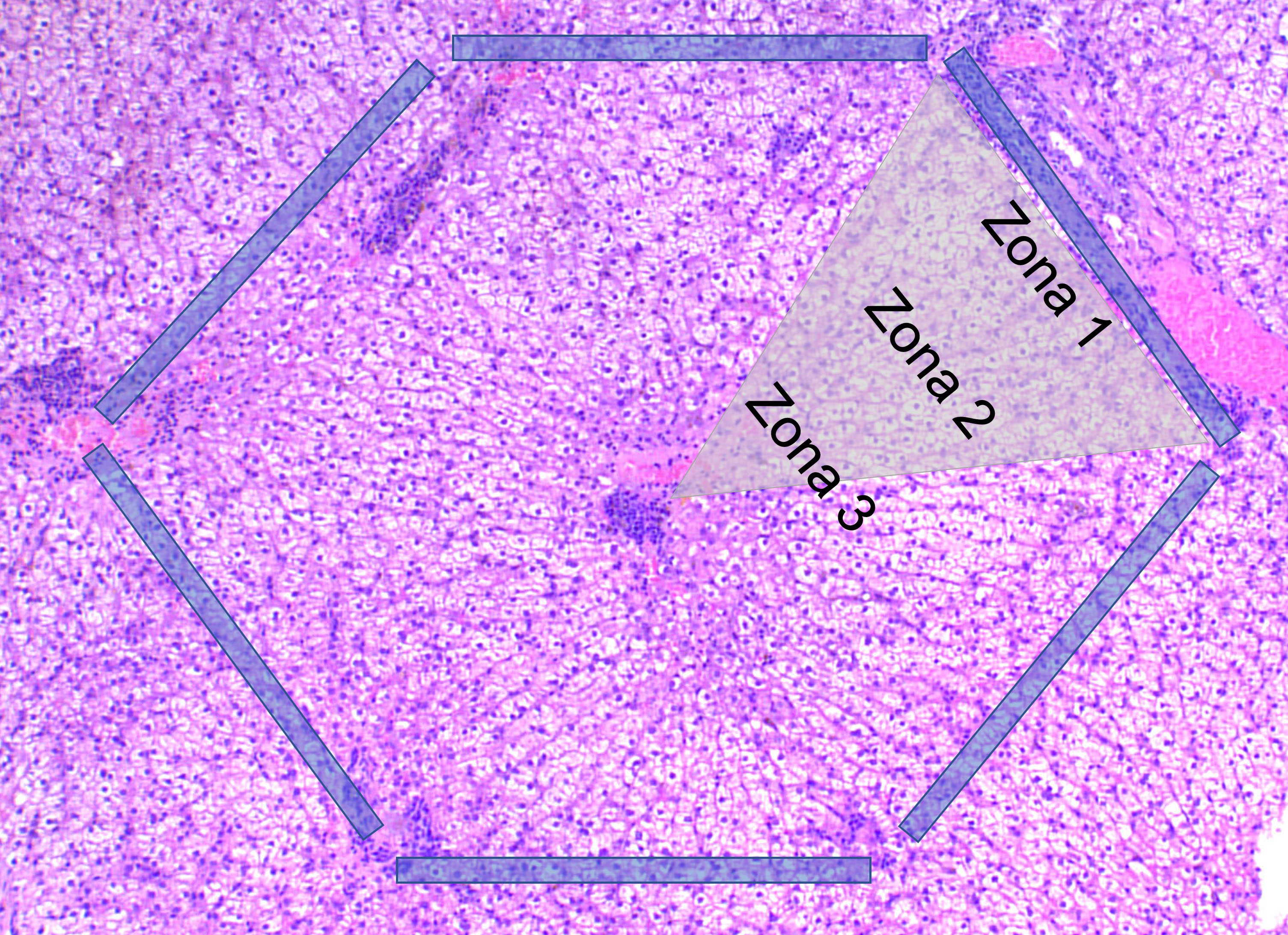 BIOPSIA EPATICA ISTOLOGICA: LE DIMENSIONI CONTANO!