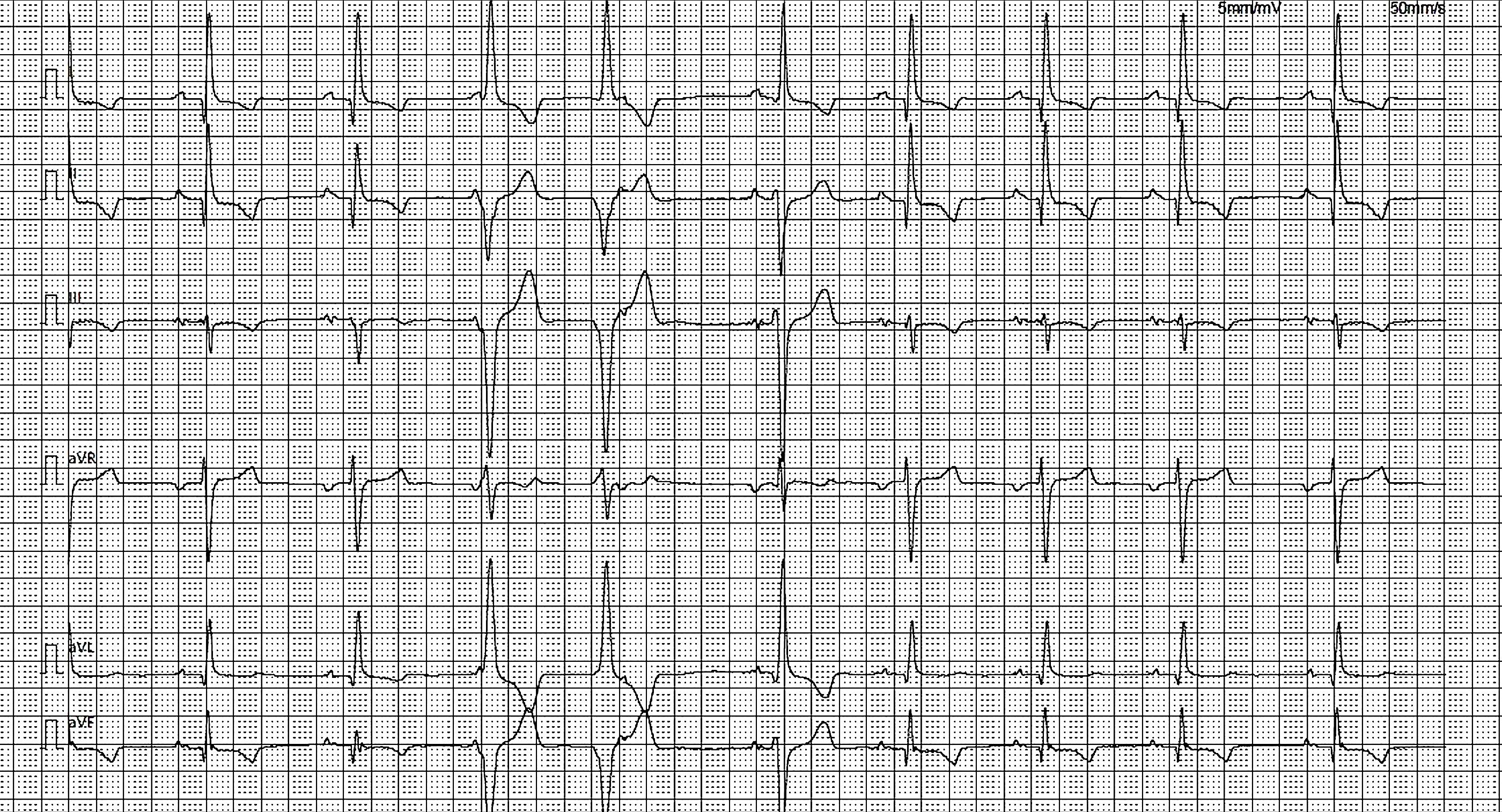 LA MIOCARDITE NEL CANE: UNA SFIDA DIAGNOSTICA COSTANTE