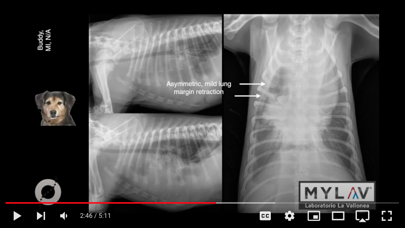 I CASI RADIOLOGICI DI GILIOLA SPATTINI: COME DISTINGUERE UNA MASSA MEDIASTINICA DA UN'ERNIA DIAFRAMMATICA?