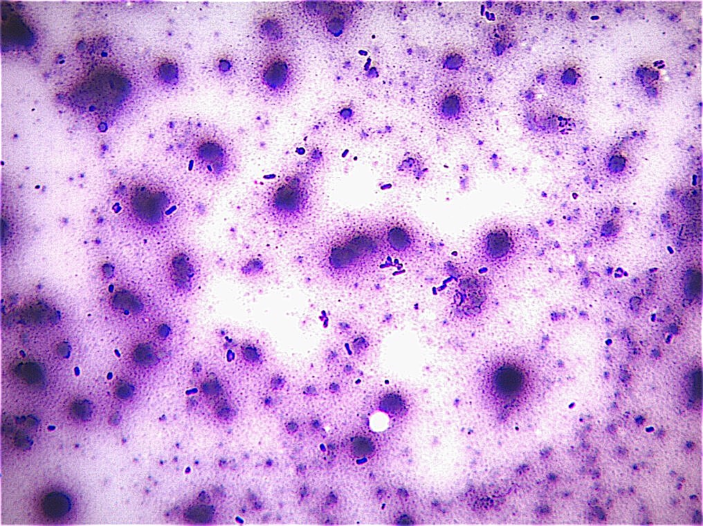 Cosè la bactobilia in citologia?