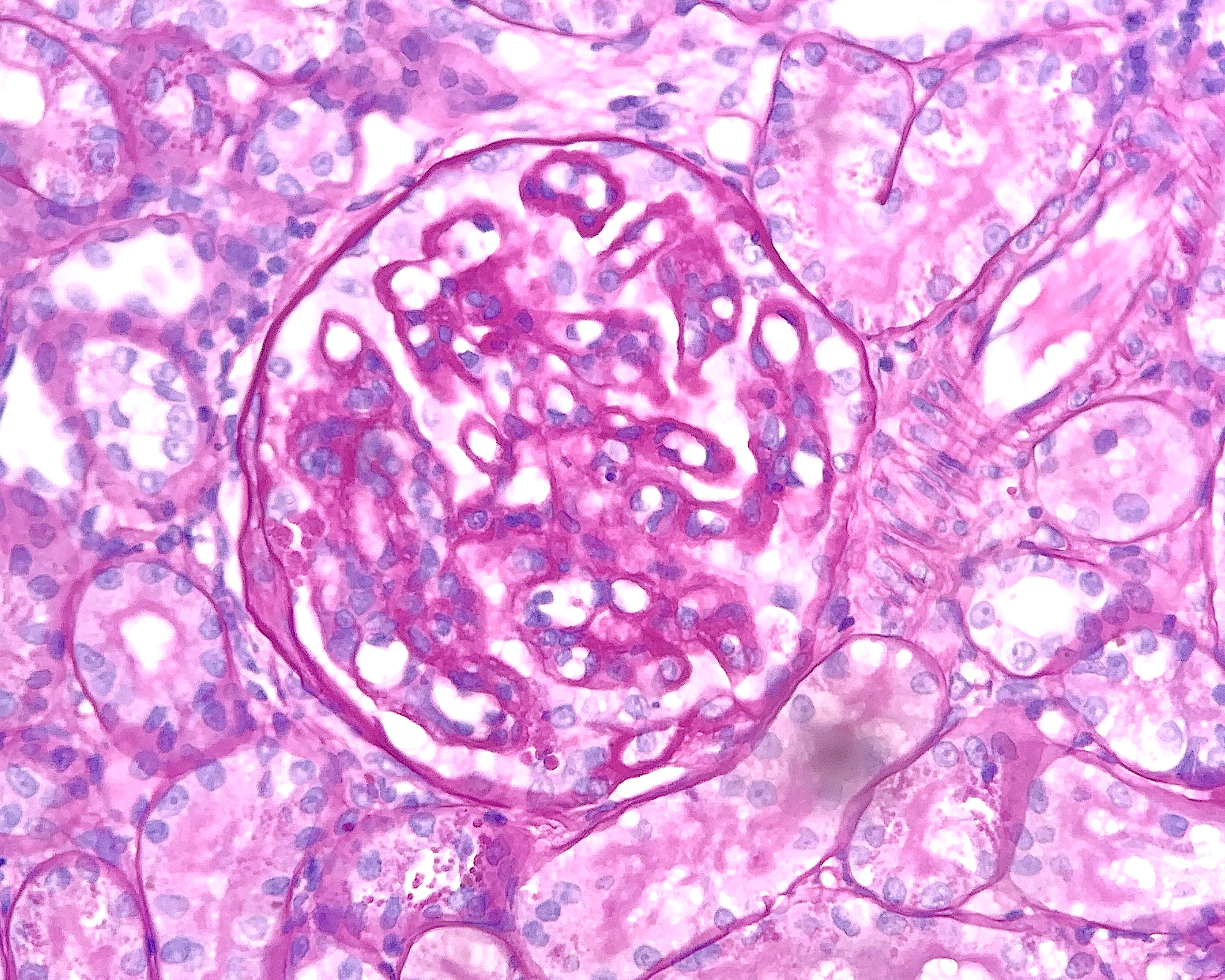 Le glomerulopatie immuno-mediate del gatto non sono poi così rare