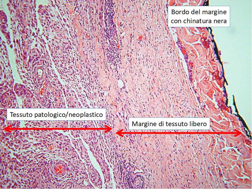 Novità 2019: lo studio perimetrale dei margini di escissione chirurgica