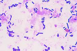 Il campionamento in microbiologia - 6^ parte